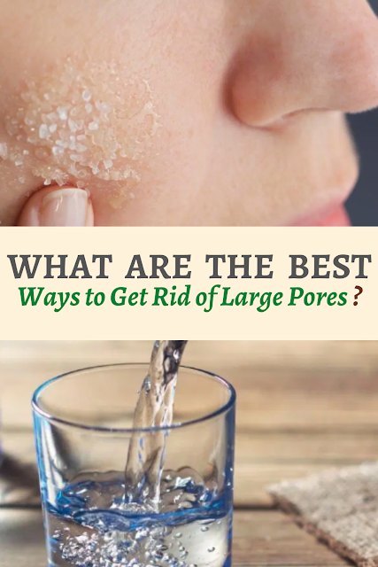 What are the Best Ways to Get Rid of Large Pores?