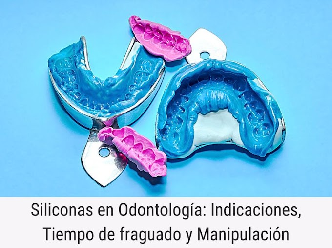Siliconas en Odontología: Indicaciones, Tiempo de fraguado y Manipulación