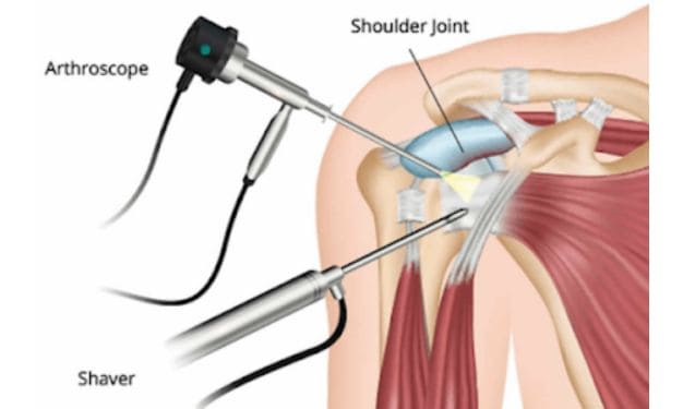 FDA 21 CFR Part 888 Orthopedic Devices