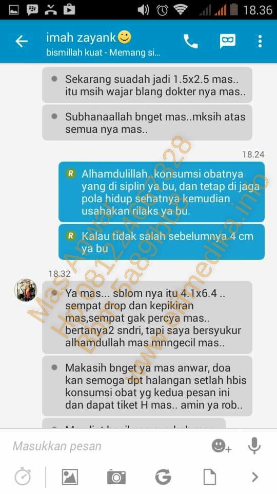 Testimoni Pasien Kista Ovarium Klinik  Holistik Elif Medika 