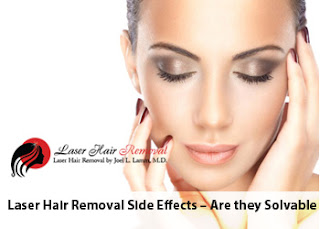 laser hair removal treatments