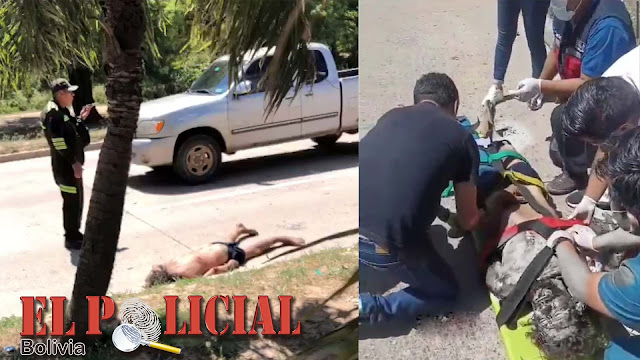 Santa Cruz: Reportan que el popular "Vinchita" un hombre en situación de calle, fue atropellado y su estado es delicado