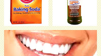 How Much Is It For Teeth Whitening