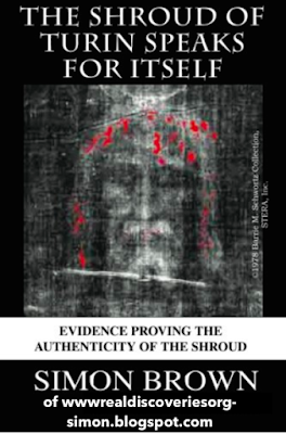 The Shroud of Turin Speaks for Itself