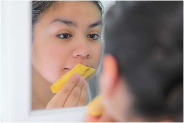  ibarat ini manfaat kulit pisang bagi kesehatan dan kecantikan 5 Manfaat Kulit Pisang Bagi Kesehatan & Kecantikan + Cara Penggunaan