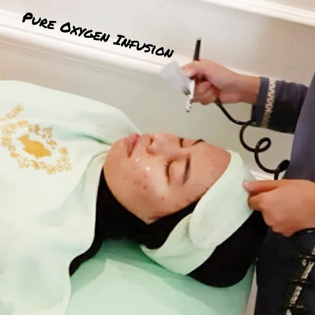 harga insta beauty center, harga perawatan di insta beauty center, insta beauty center price list, harga filler hidung di insta beauty center, klinik insta beauty center, beauty center jakarta, dokter siska beauty center