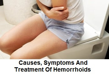 Causes, Symptoms And Treatment Of Hemorrhoids