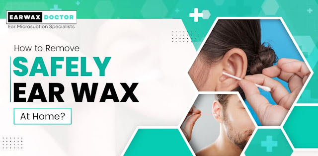 Earwax Removal, How to Safely Remove an Earwax Blockage at Home
