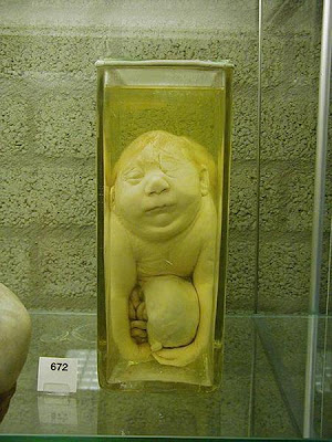 gambar kelainan bayi, museum bayi mengerikan, bayi abnormail, manusia aneh, gambar foto menyeramkan