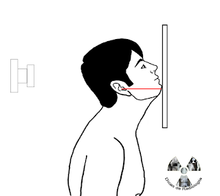 PARIETOACANTIAL TRANSORAL