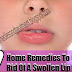 Best Home Remedies to get rid of a swollen lip fast, 7 Home Remedies............