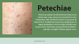 petechiae