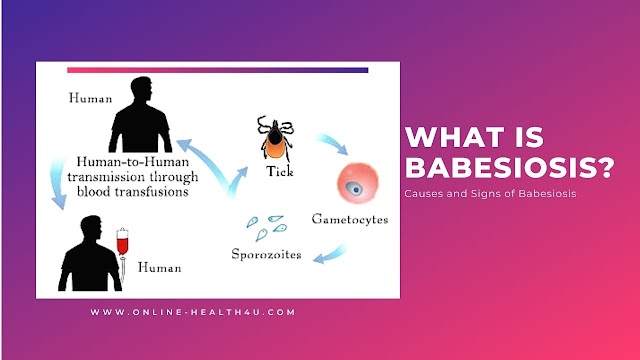 What is Babesiosis | Causes and Signs of Babesiosis 2021