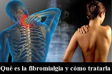 ¿De qué trata la Fibromialgia, cuáles son los síntomas y su tratamiento?