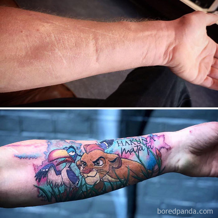 30 Times Tattoo Artists Did An Awesome Job Covering Up People's Scars And Birthmarks