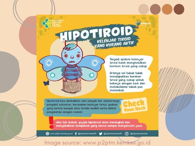 hipotiroid pada anak