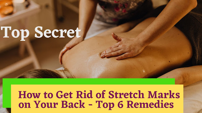 back stretch marks oiling