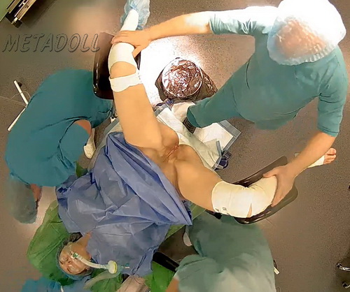 Hospital Secretly Filmed Women During Surgery (Women during operation 08)