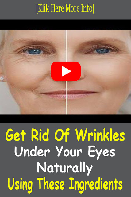 How To Get Rid Of Wrinkles Under Eyes