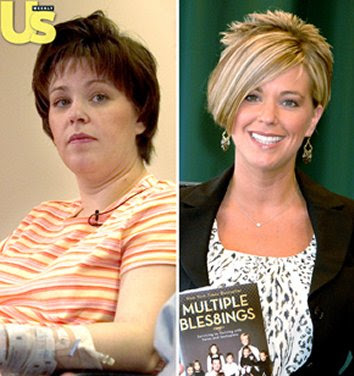 Kate Gosselin before and after photo.