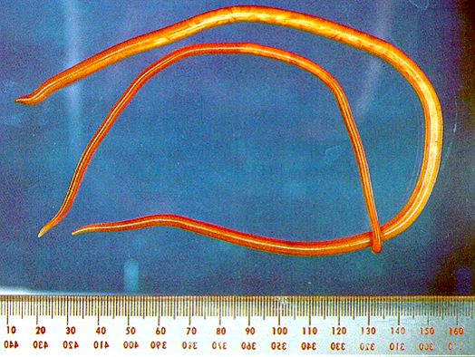 Parasitologi Ascaris  lumbricoides  Cacing  gelang 