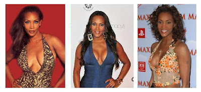 Vivica Fox Plastic Surgery