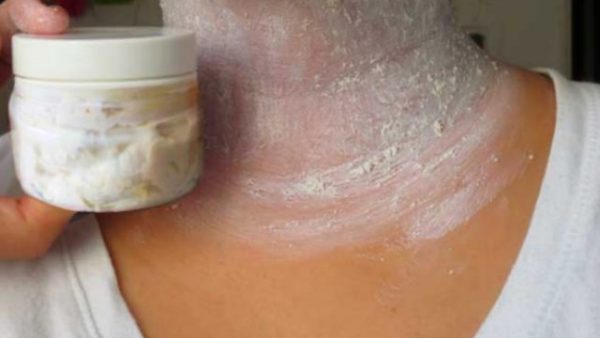 Remove Annoying Brown Spots On The Neck, Armpits And Inner Thighs In 15 Minutes