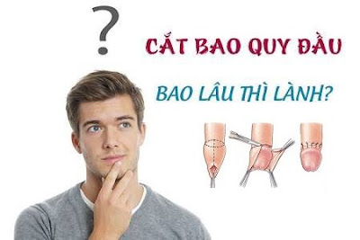 Cắt bao quy đầu bao lâu thì khỏi