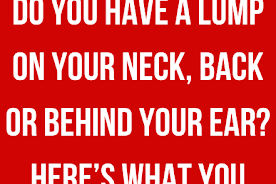 Do You Have A Lump On Your Neck, Back Or Behind Your Ear? Here’s What You Need To Know