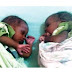 WHAT!!! : Woman Abadons Her New Born Twin Babies Because She Couldn't Pay Hospital Bills... Continue Reading 