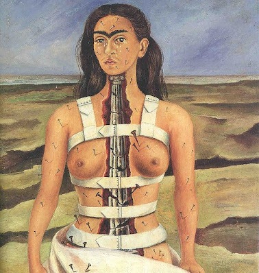 Frida Kahlo and chronic pain