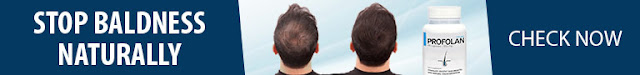 How can I stop losing my hair?