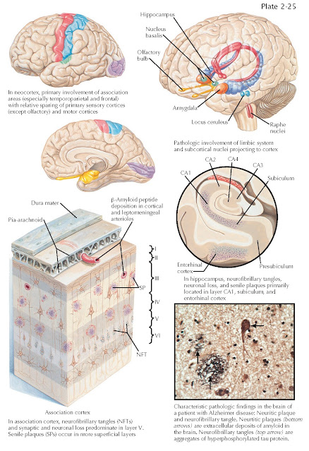 ALZHEIMER DISEASE: DISTRIBUTION OF PATHOLOGY