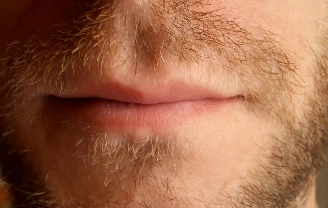 Bocca maschile guarita dall'herpes labiale