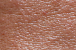 open pores skin images