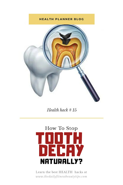 Tooth-decay=treatment