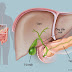 Dấu hiệu, triệu chứng của bệnh sỏi trong gan