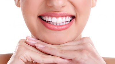 Trồng răng implant có tốt không? 2