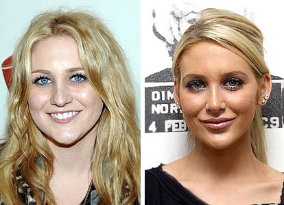 heidi montag before and after plastic surgery. Stephanie Pratt efore and