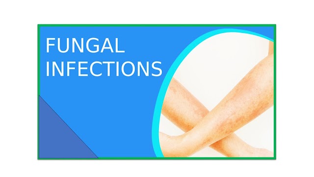 How to get rid of fungal infection