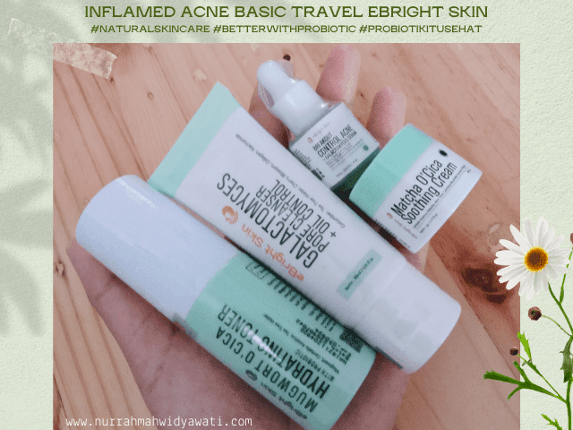 Skincare Routine untuk Kulit Bruntusan berjerawat sensitif acne prone