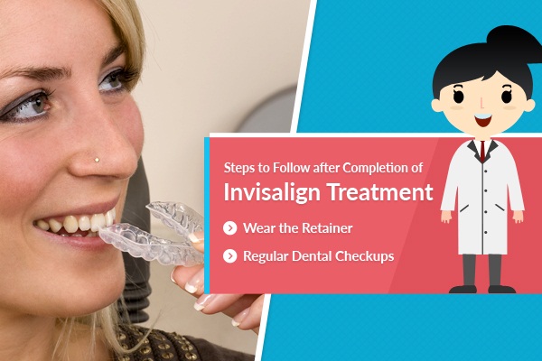 Steps to Follow after Completion of Invisalign Treatment