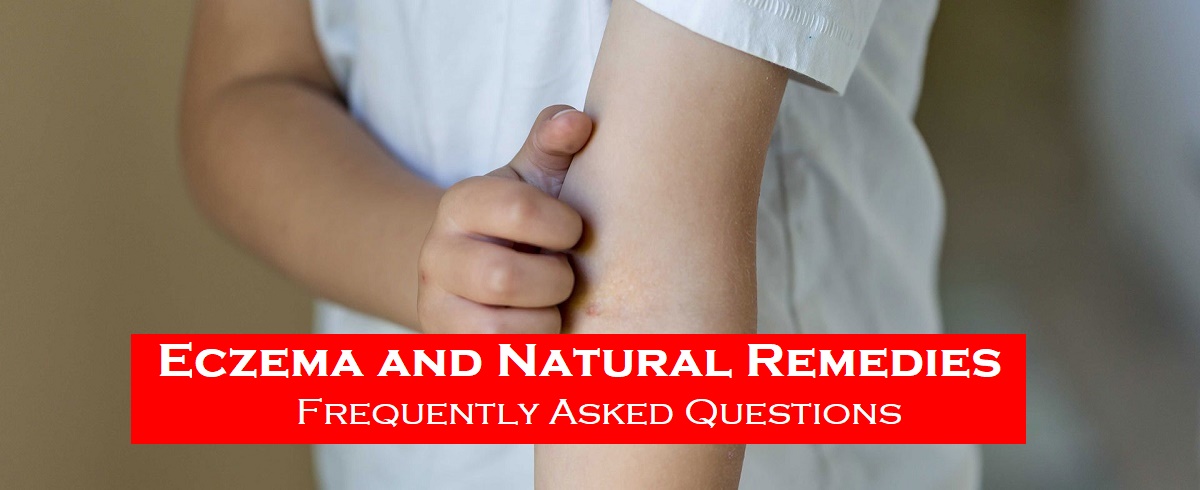 Eczema and Natural Remedies Frequently Asked Questions.