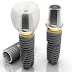 Cấy ghép implant có hiệu quả gì?