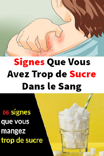 signaux-trop-de-sucre