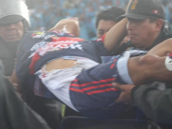 Sport Águila player Joao Contreras injured after being struck by lightning during match