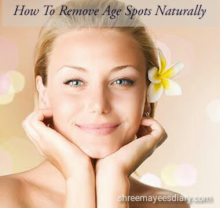 Age spots, natural remedies, hacks