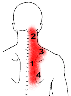How To Relieve Neck Pain Problem