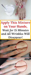 Apply This Mixture on Your Hands, Wait for 15 Minutes and All Wrinkles Will Disappear!