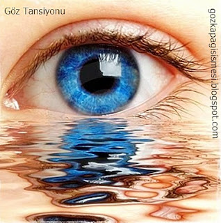 Göz Tansiyonu